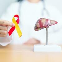 Doctor with Red and Yellow ribbon and human Liver anatomy model. World hepatitis day, 28 July, Liver cancer awareness month, Jaundice, Cirrhosis, Failure, Enlarged, Hepatic Encephalopathy and Health photo