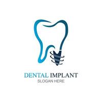 Dental implant logo design concept vector, Dental Care logo template vector