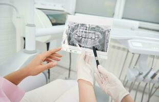 atención en radiografía fotografía en el manos de un dentista demostración mandíbula y dientes, que se discute con un paciente durante dental examen, explicando el consultas tratamiento asuntos. diagnósticos en odontología foto