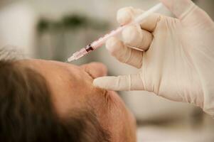 Soft focus on a syringe with beauty product on the beautician hands in white surgical gloves making injection on the face of middle aged man for rejuvenation and anti-aging treatment in wellness spa photo