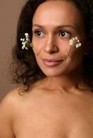 Pretty woman with vitiligo and dermatological skin problems posing with Gypsophila white sprigs on her face. Cosmetology, dermatology, body positivity, skin care concept. Beige background. Close-up. photo