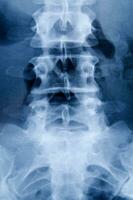 un X - rayo imagen de un de la persona espalda foto