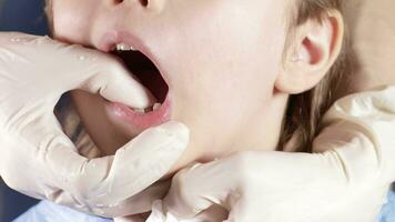 uma jovem Garoto é obtendo dele dentes verificado de uma dentista video