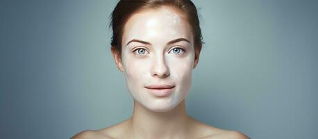 Digital composite photo featuring a Caucasian woman with diverse skin tones with text for International Skin Pigmentation Day on a blue frame Symbolizes p