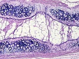 histology human tissue with microscope from laboratory photo