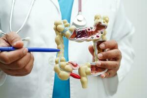 Intestine, doctor holding anatomy model for study diagnosis and treatment in hospital. photo