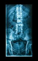 X-Ray image, View of backbone men for medical diagnosis. photo