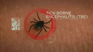 Tick on human skin is scanned for Tick-borne encephalitis disease infection. Digital HUD overlay video