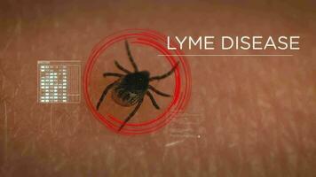 Tick on human skin is scanned for LYME infection. Digital HUD overlay, disease analysis video