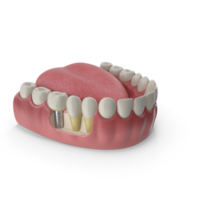 mandibular humano Chiclete e dentes. medicamente preciso dente 3d ilustração, boca Chiclete e dentes. medicamente preciso dente 3d ilustração png