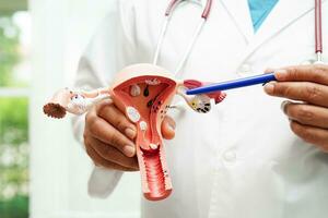 Uterus, doctor holding anatomy model for study diagnosis and treatment in hospital. photo