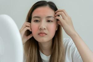 Young woman asian are worried about faces Dermatology and allergic to steroids in cosmetics. sensitive skin, red face from sunburn, acne, allergic to chemicals, rash on face. skin problems and beauty photo