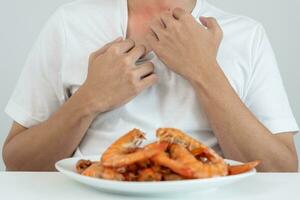 comida alergias, hombres tener reacciones Comezón y enrojecimiento después comiendo camarón, Mariscos alergia, picor, erupción, abdominal dolor, diarrea, cofre opresión, inconsciencia, muerte, grave evitar alergias foto