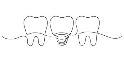 dientes fila con sano y implante diente, continuo Arte línea dibujo. odontología salud. vector mano dibujado ilustración