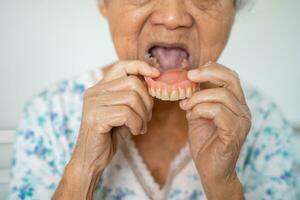 Asian elderly woman patient holding to use denture, healthy strong medical concept. photo