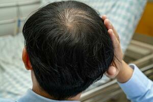 calvo en la cabeza media y sin pérdida de cabello glabro de hombre de oficina activo inteligente de negocios asiáticos maduros. foto