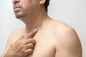 middle age senior man point to skin tags or acrochordon on his neck isolated on white background. Health care photo