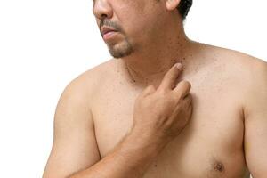 middle age senior man point to skin tags or acrochordon on his neck isolated on white background. photo