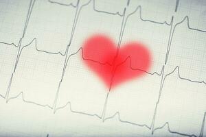 EKG graph.Electrocardiogram ekg ecg with red blurred heart. photo