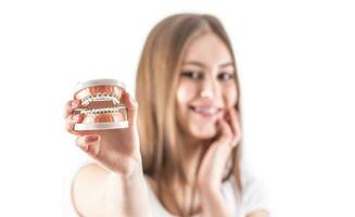 Model of a dental braces in the hand of a young teenage girl photo