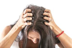 Brunette woman on isolated background scratching her head because of strong head itching photo