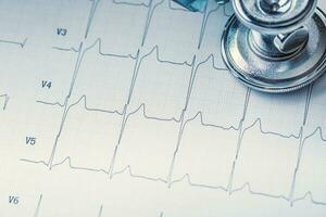 Stethoscope on a heart monitor printout.Electrocardiogram chart and stethoscope. photo