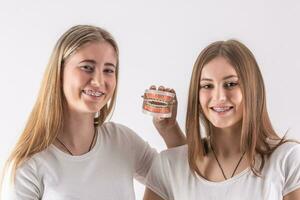 Two cheerful teenagers show in front of them a model of teeth with a braces photo