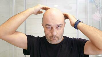 skallig man rädd av förlorande hår video