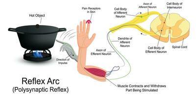 Reflex Arc infographic diagram with example. vector