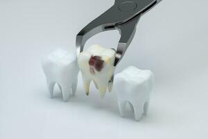 The sick tooth being pulled out, 3d rendering. photo