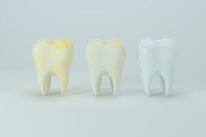 Changing of the tooth color from yellow to white, 3d rendering. photo