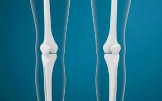 Leg bones and knees, 3d rendering. photo