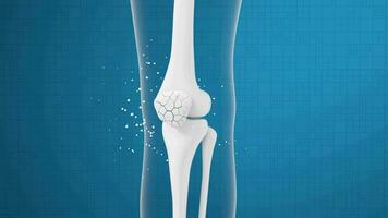 Leg bone and knee healing, 3d rendering. video