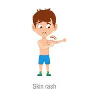 Child with skin rash disease, boy with itchy spots vector