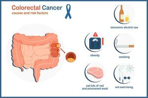 médico vector ilustración causas y riesgo factores ese porque colon cáncer.obesidad,beber alcohol, no hacer ejercicio, comer rojo y procesada carne y fumar.plano estilo aislado en blanco antecedentes.