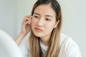 mujer preocupada por la dermatología facial, dermatitis rosácea, esteroides alérgicos, piel sensible, cara roja por quemaduras solares, acné, piel seca, poros dilatados, erupción facial, opaca, pecas, arrugas, problemas de piel foto