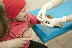 el manos de el médico vendaje el dolorido dedo con un vendaje de el niño. lesión y herida en el dedo en niños foto