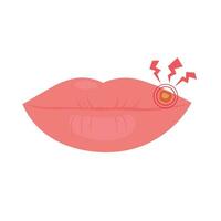 Lips affected by herpes. Vector illustration. Isolated on a white background. A wound on a woman's lips. Packaging of the virus medicine.