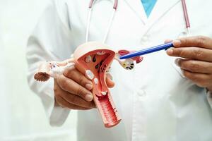 Uterus, doctor holding anatomy model for study diagnosis and treatment in hospital. photo