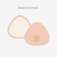 Breast prosthesis. Breast prosthesis for breast cancer patient after mastectomy. Vector illustration.