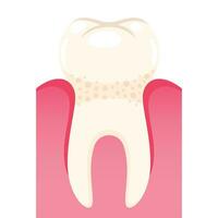 Vector strong tooth in gum on white background