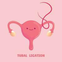 tubal ligation medical procedure vector illustration
