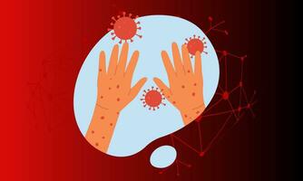 Monkeypox virus banner virus outbreak pandemic design with microscopic view background. Vector illustration