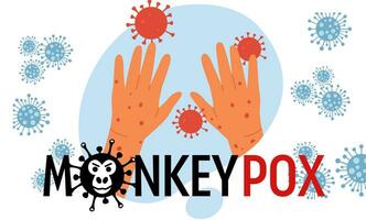 Monkeypox virus banner virus outbreak pandemic design with microscopic view background. Vector illustration