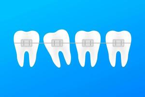 Correction of teeth with orthodontic braces. Stages of teeth alignment. Dental clinic services. Vector stock illustration.