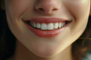 joven mujer con hermosa sano sonrisa, de cerca. dental cuidado. ai generado Pro foto