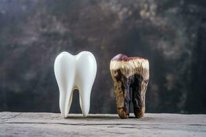 Decayed tooth comparison with a healthy one background with empty space for text photo