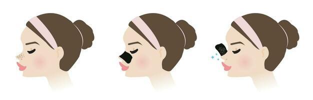 Cute woman with blackhead pore strip on nose side view vector illustration isolated on white background. Direction for use, how to use, step of use blackhead removal nose pore strip.