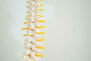 Spinal nerve and bone, Lumbar spine displaced herniated disc fragment, Model for treatment medical in the orthopedic department. photo