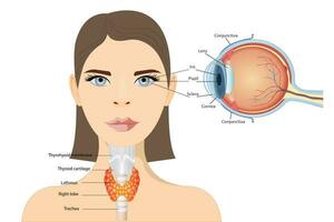 Anatomical diagram of the human eye. Cross section of a sense organ with all components such as the lens, retina, optic nerve , and iridescent skin of the iris. Medical infographic with side and side vector